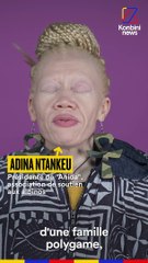 Le Speech d’Adina Ntankeu, militante albinos