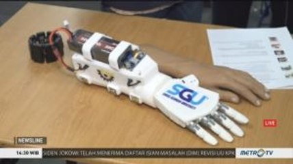 Tangan Bionik Karya Anak Bangsa