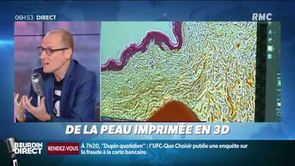 La chronique d'Anthony Morel : De la peau imprimée en 3D - 12/09