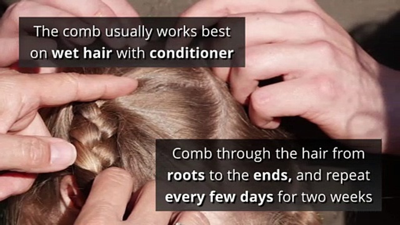 Head lice - How to treat head lice without seeing a GP