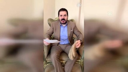 "Raynaud fenomeni" hastası tiftik eldivenlerine kavuştu