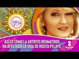 Así es como la artritis reumatoide ha afectado la vida de Rosita Pelayo | Sale el Sol