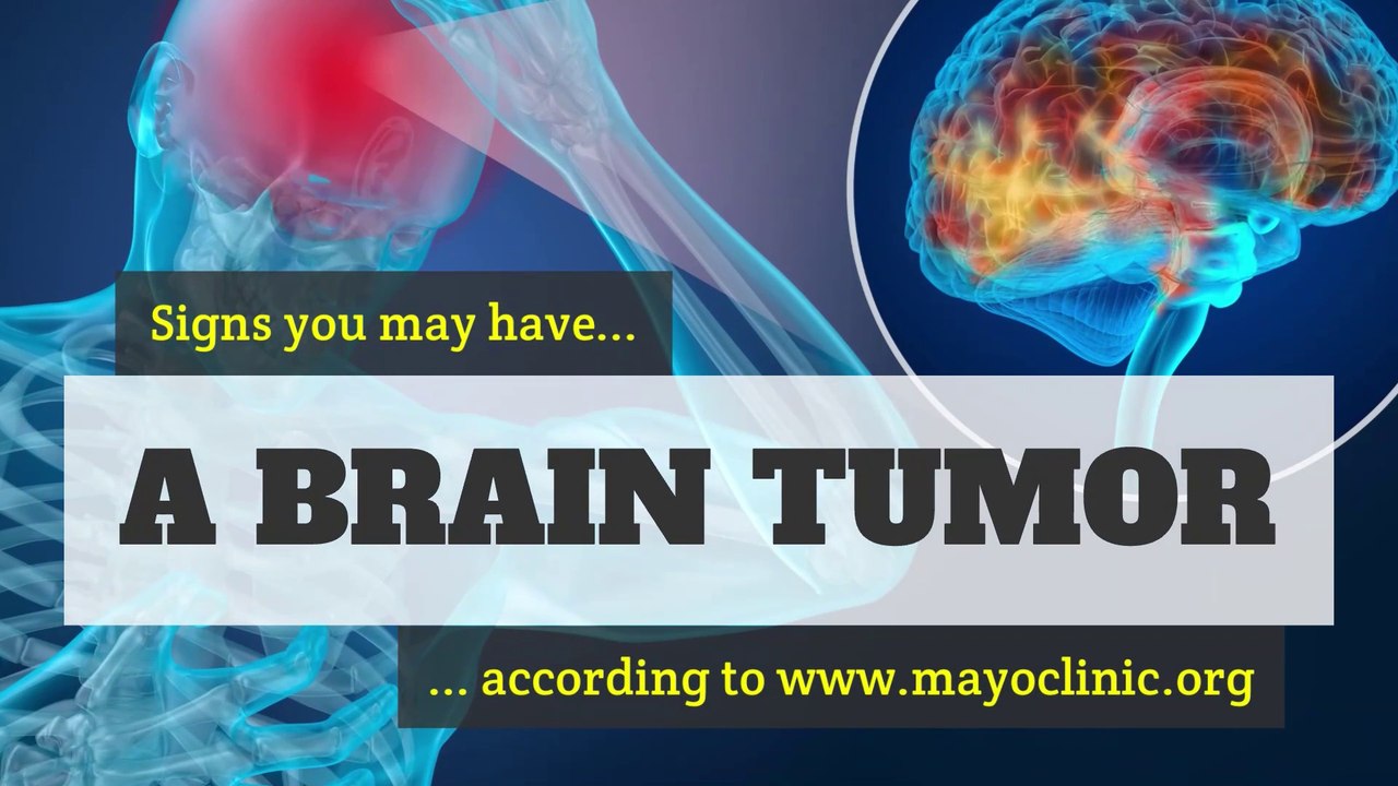 Brain tumour - Signs you may have a brain tumour
