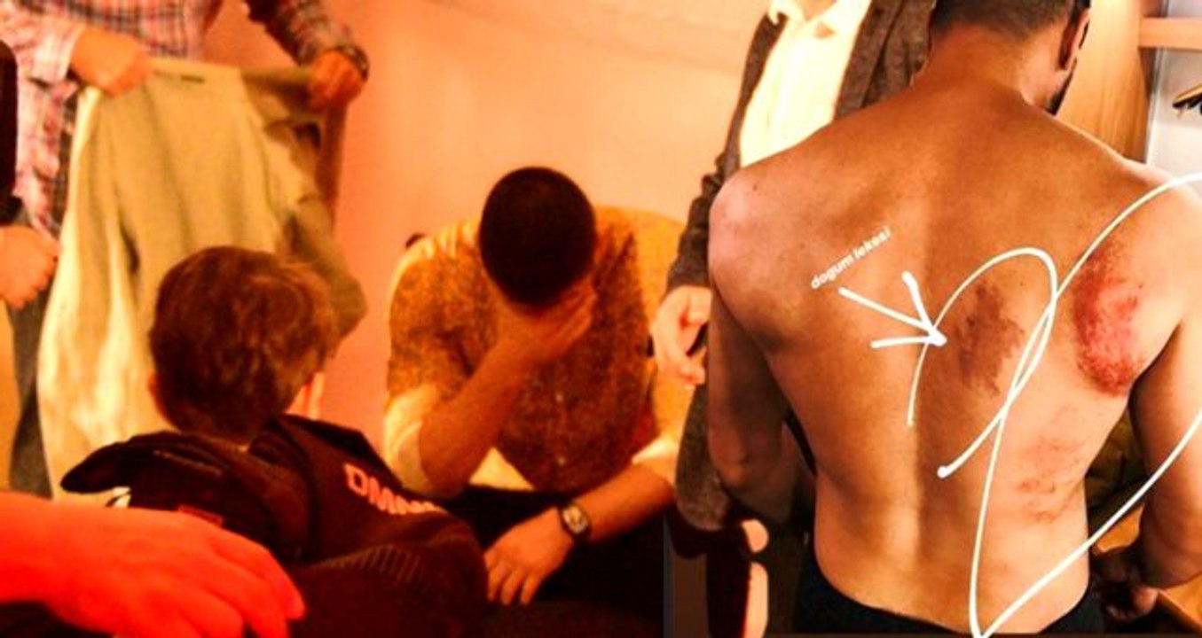 Tolgahan Sayışman, dizisinin ilk bölümünün yayınlandığı gece fenalaştı