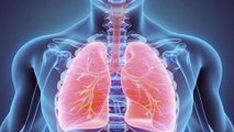 ماذا تعرف عن.. ذات الرئة وكيف يصاب الإنسان به؟ | العيادة