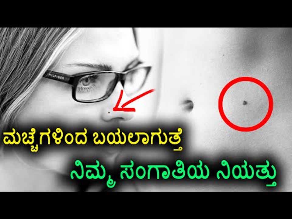 Moles reveals your partner's loyalty | Watch video | BoldSky Kannada