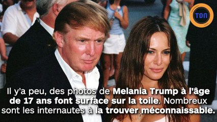 Melania Trump : des photos  du passé interrogent sur sa  possible chirurgie esthétique !