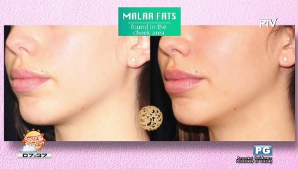 DERMAESTHETIC: Lipo cavitation