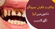 Chocolate, Sweets and Chewing Gums are the main cause of teeth infection