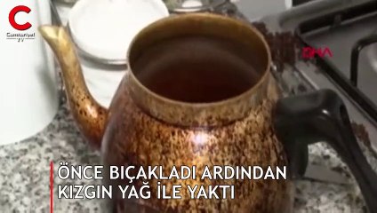 Önce bıçakladı ardından kızgın yağ ile yaktı