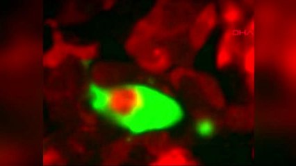 Dha dış ' kanser hücrelerinin 'yamyamlık' yaparak hayatta kaldıkları keşfedildi