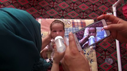 Ölümü Bekleyen Asel Bebek İçin Umut Işığı Doğdu
