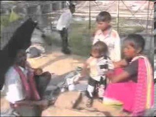 Lucknow Kukrail Dog Bite "Believe It Or Not" - Webdunia