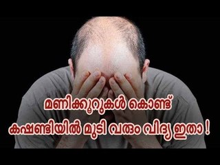 മണിക്കൂറുകള്‍ കൊണ്ട് കഷണ്ടിയില്‍ മുടി നിറയും വിദ്യ ഇതാ