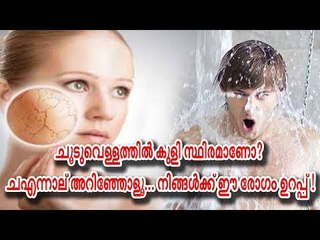 ചൂടുവെള്ളത്തില്‍ കുളി സ്ഥിരമാണോ? എന്നാല്‍ അറിഞ്ഞോളൂ... നിങ്ങള്‍ക്ക് ഈ രോഗം ഉറപ്പ് !
