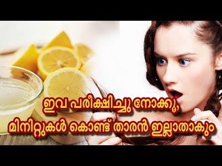 ഇവ പരീക്ഷിച്ചു നോക്കൂ, മിനിറ്റുകള്‍ കൊണ്ട് താരന്‍ ഇല്ലാതാകും