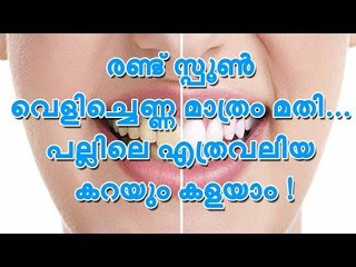 രണ്ട് സ്പൂൺ വെളിച്ചെണ്ണ മാത്രം മതി... പല്ലിലെ എത്രവലിയ കറയും കളയാം !