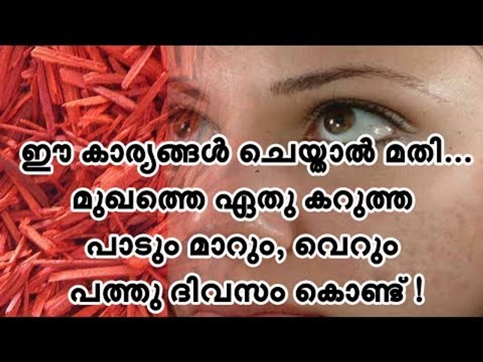 ഈ കാര്യങ്ങള്‍ ചെയ്താല്‍ മതി... മുഖത്തെ ഏതു കറുത...