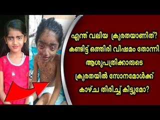 ബോധം കെട്ട് പനിച്ച് വിറച്ച കുട്ടിയെ കണ്ടതേ അപസ്മാരത്തിന് ചികില്‍സ തുടങ്ങി...