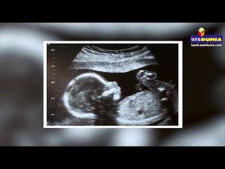 ஆண் குழந்தை பிறந்ததால் பிறப்புறுப்பை வெட்டிக் கொலை செய்த மருத்துவர்