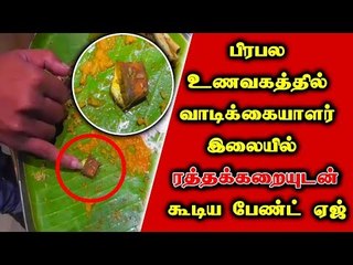 பிரியாணியில் ரத்தக்கறையுடன் bandage tape..!