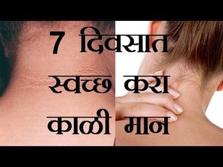 मान काळी झालीये? मग घरगुती उपायाने सात दिवस स्वच्छ करा