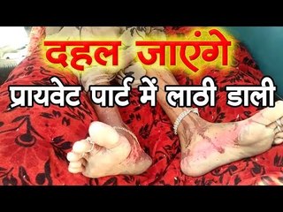 दहल जाएंगे - प्रायवेट पार्ट में लाठी डाली   Crime News