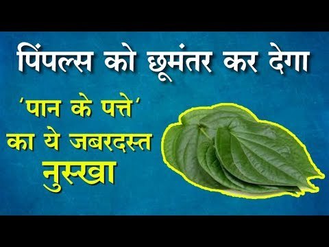 एक रात में मुंहासे भगाना है, तो तुरंत अपनाएं 'पान के पत्ते' का ये खास नुस्खा