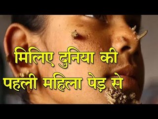 मिलिए दुनिया की पहली महिला पेड़ से