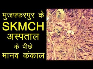 Bihar में SKMCH हॉस्पिटल के पीछे मानव कंकाल
