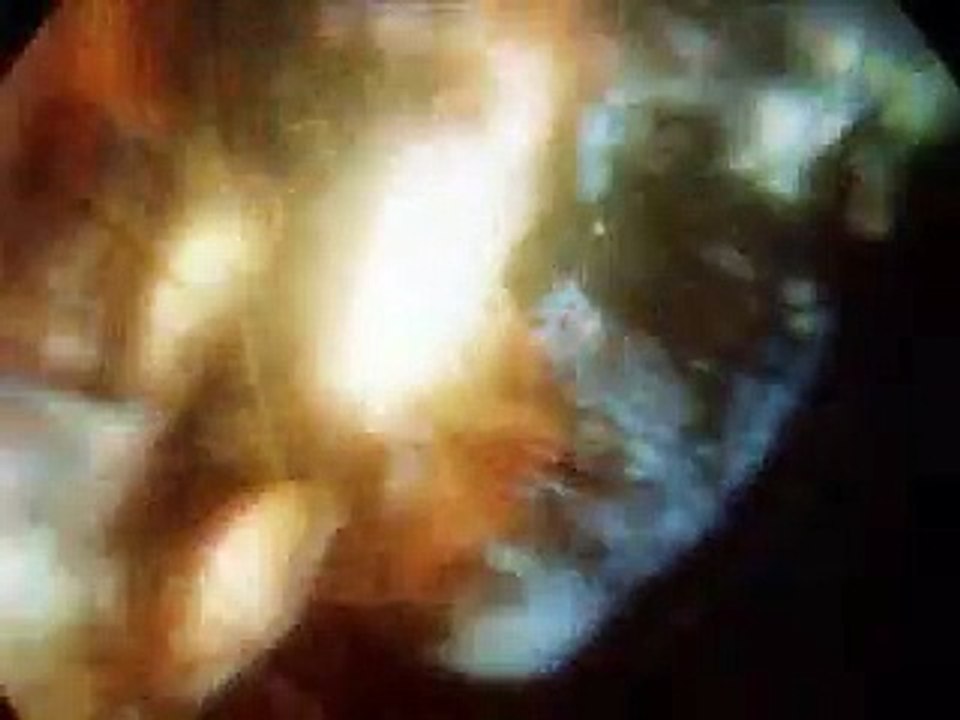 LSD- hallucinogens_