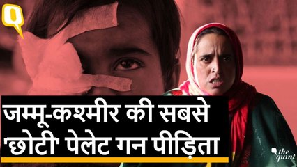 J&K: सबसे छोटी Pellet gun victim बच्ची Hiba की मां का सवाल- ‘क्या वो आतंकवादी है?’