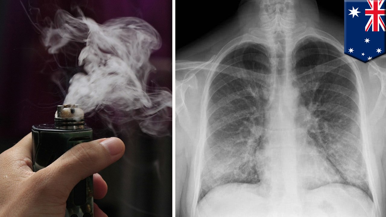 Flavored e-cigarette vapor toxic to lung cells even without nicotine