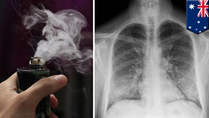 Flavored e-cigarette vapor toxic to lung cells even without nicotine