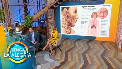El lupus es una enfermedad silenciosa. Nuestro experto nos explica los detalles. | Venga La Alegría