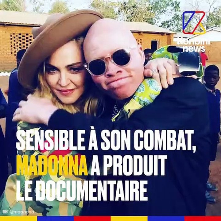 Lazarus Chigwandali, le musicien de rue qui se bat contre la persécution des albinos