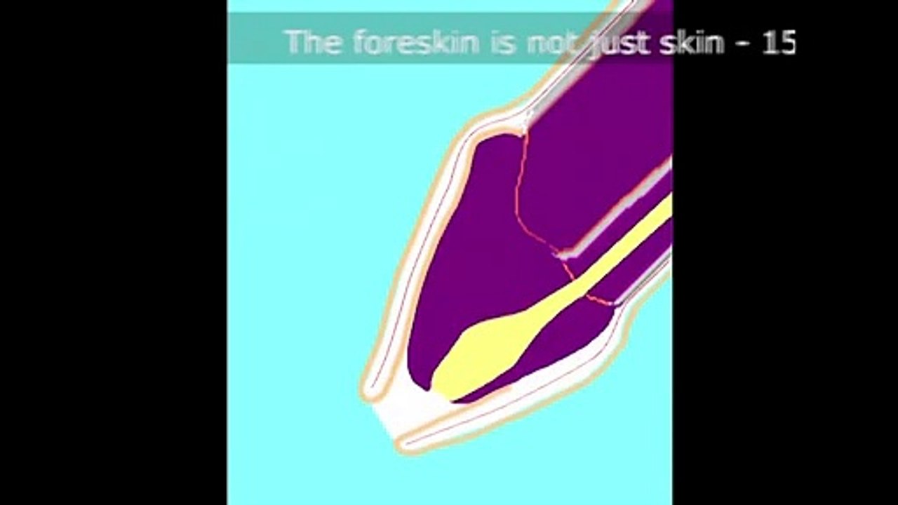 “Not just skin” – old version.