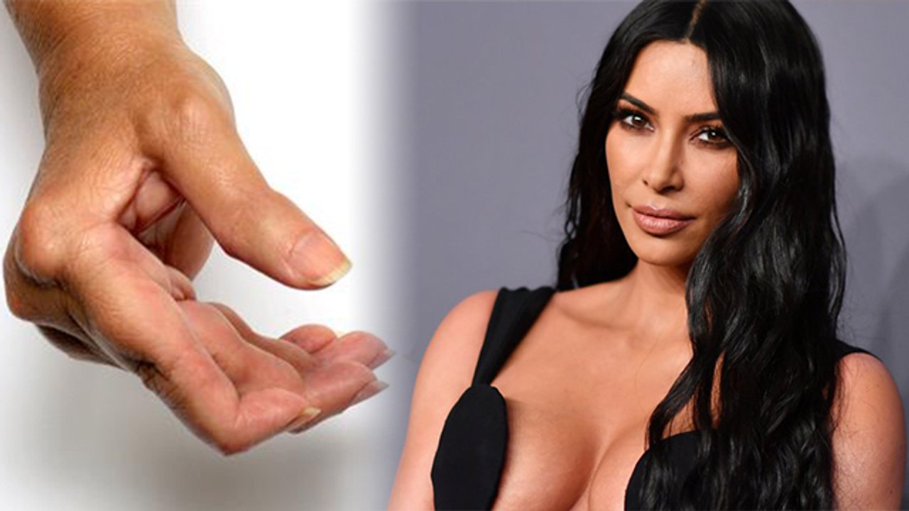 रूमेटॉयड ऑर्थराइटिस से जूझ रही फेमस मॉडल किम कार्दशियन | Rheumatoid Arthritis symptoms | Boldsky