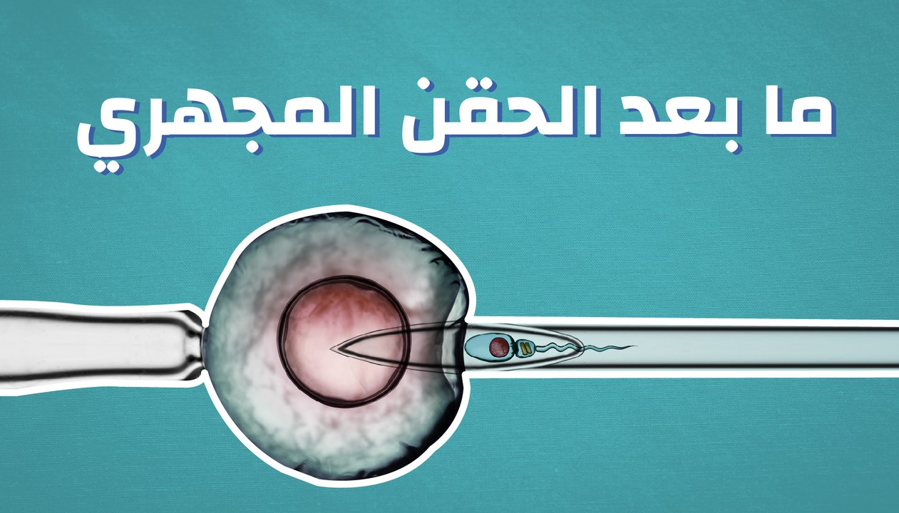 ما بعد الحقن المجهري
