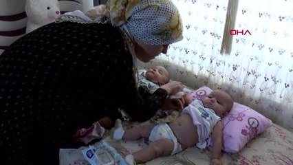 Ecrin bebek için sevindirici ameliyat olacak