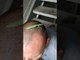 Insect Crawls All Over Man's Head