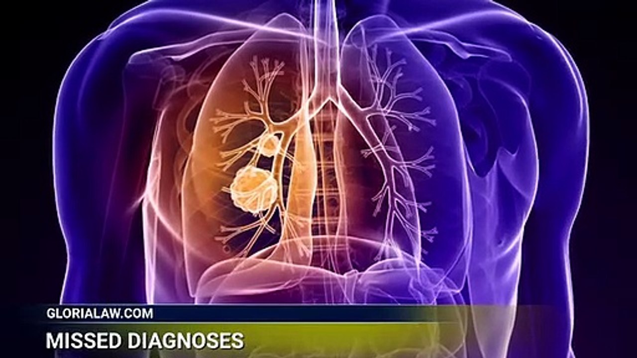 Missed diagnosis with tragic results | Medical Malpractice Lawyer Stuart FL