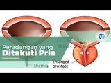 Prostatitis, dikenal juga sebagai Radang Prostat