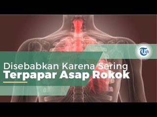 Bronkitis, Infeksi Saluran Pernapasan Utama dari Paru-paru