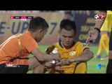 Cận cảnh chấn thương rợn người của Minh Tùng trong trận đấu đầy bạo lực trên SVĐ Lạch Tray
