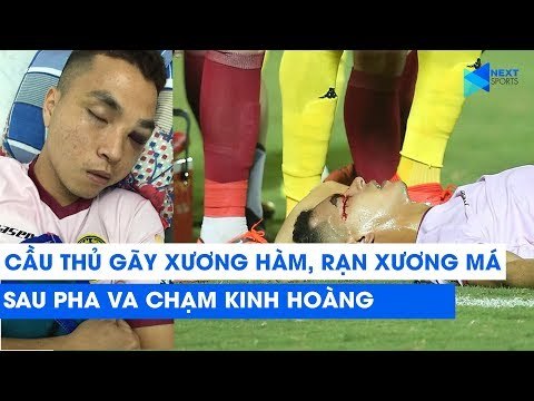 Cầu thủ gãy xương hàm, rạn xương má, tụ máu não sau pha va chạm kinh hoàng | NEXT SPORTS