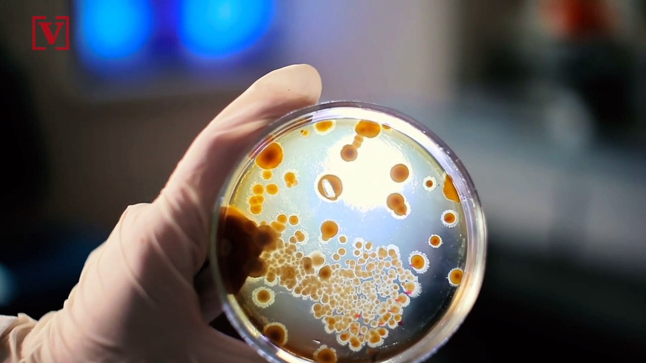 Drug-Resistant Germs Might Be Lurking In Your W...