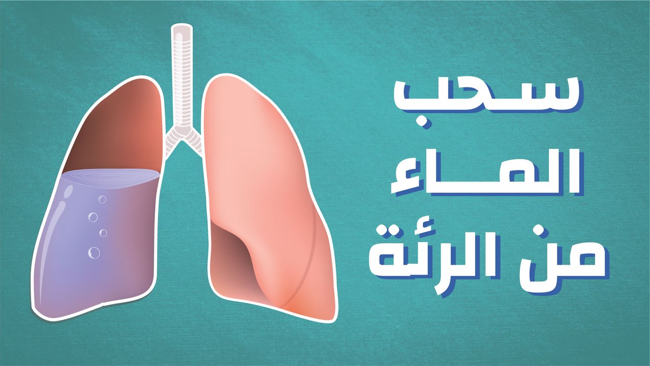 كيف يتم سحب الماء من الرئة