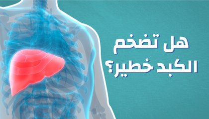 تضخم الكبد هل هو خطير