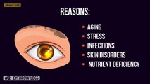 you don`t know what your eyes say about your health!